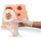 Ostomy Care Model SKU: SB23501