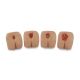 Life/form® Pressure Ulcer/Bedsore Model